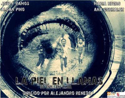 La piel en llamas